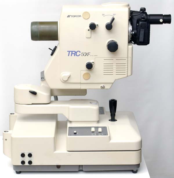 Overall view of the digitally upgraded Topcon TRC-50XF