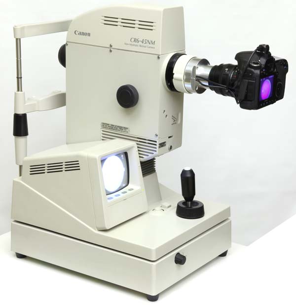 Canon CR6-45NM retinal camera with digital camera upgrade installed