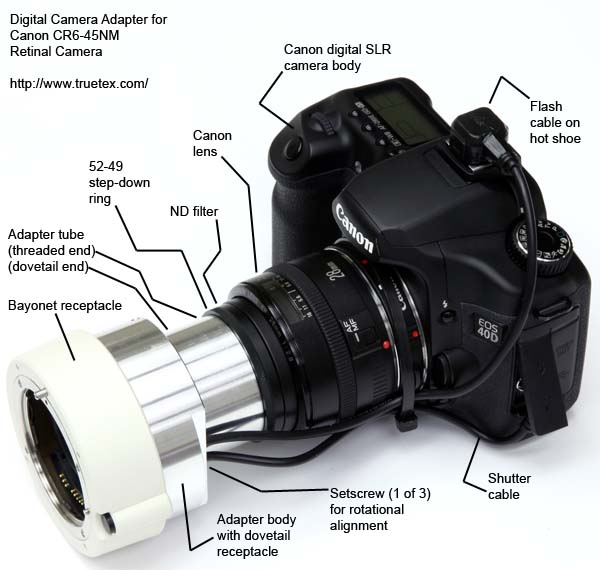 Digital camera adapter for Canon CR6-45NM retinal camera, shown with Canon lens and digital camera body