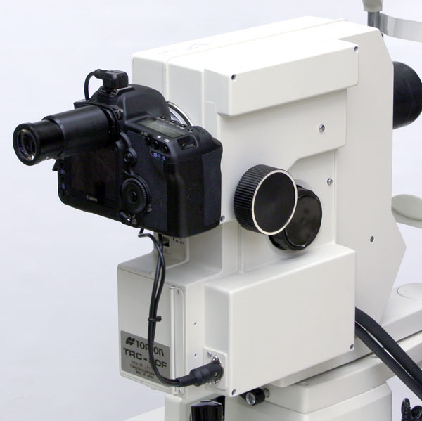 Topcon TRC-50F. Right side of the adapted instrument.