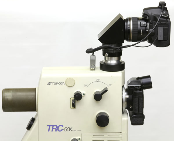 Topcon TRC-50X unit with upper-port diagonal adapter for Canon digital SLR camera