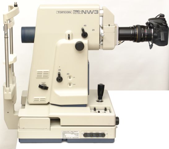 Side view of the digitally upgraded Topcon TRC-NW3