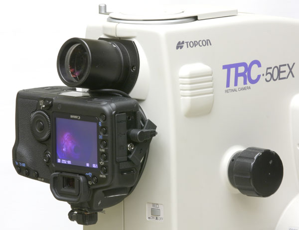 Digital camera adapted and mount on the rear port of the Topcon TRC-50EX